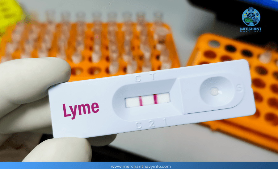 Merchant Navy Medical Test Requirements for Entry - Merchant Navy Info